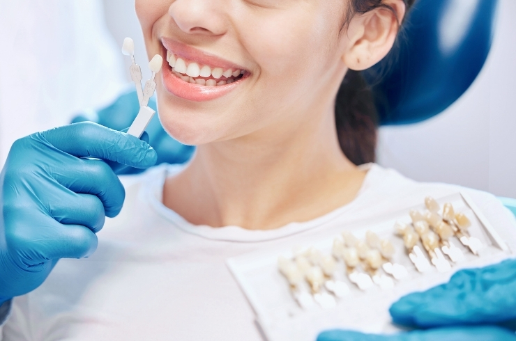 Dental Laminates & Veneers