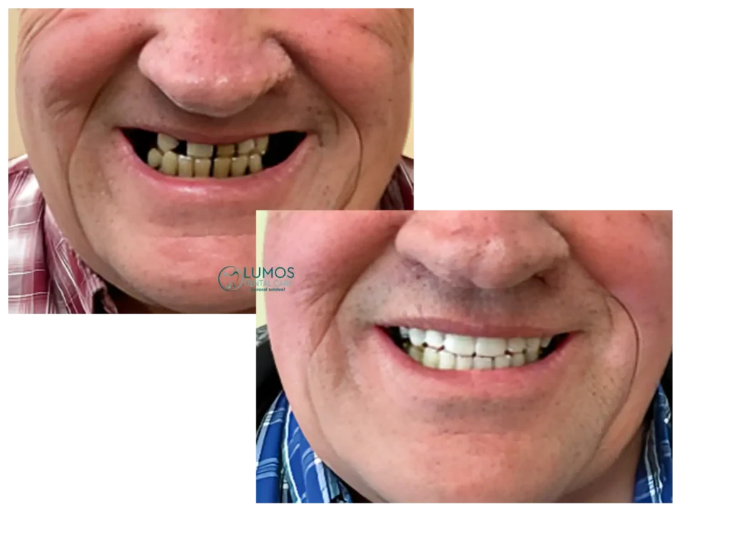 Lumos Dental Clinics Dr. Omar Sharfuddin