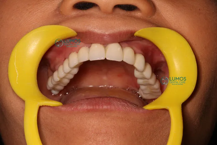Lumos Dental Clinics Dr. Omar Sharfuddin
