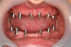 Lumos Dental Clinics Dr. Omar Sharfuddin