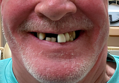 Lumos Dental Clinics Dr. Omar Sharfuddin