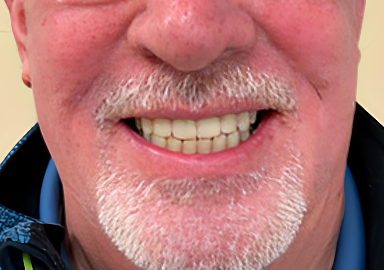 Lumos Dental Clinics Dr. Omar Sharfuddin